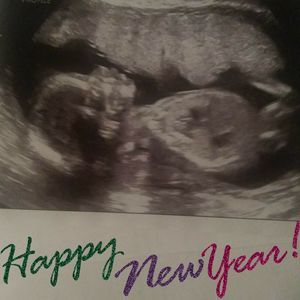 Meet your Posher, Adelaida